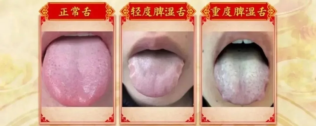 t012b4e322061bbee9f.webp.jpg